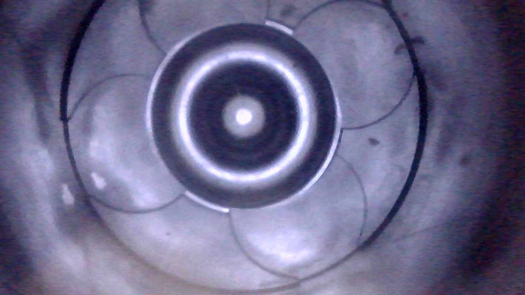 Moteur D 5244 T — vue 8